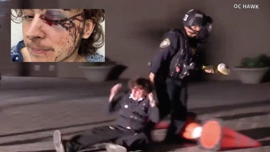 ‘No reasonable explanation’ for Homeland Security officer shooting Santa Ana protester in the face, blinding an eye, expert says